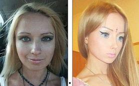 芭比整容爆料视频,视频爆料揭露明星美容秘密